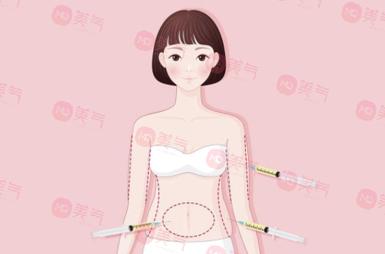 南醫(yī)大友誼吸脂價(jià)格是多少