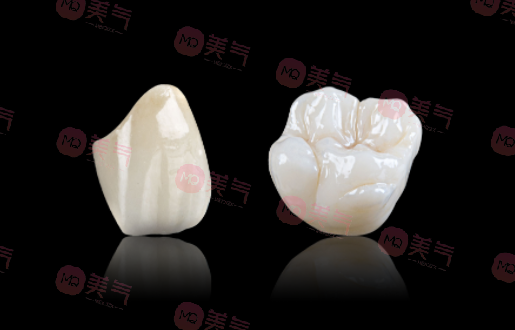 廣州全瓷牙價(jià)格多少？2023費(fèi)用明細(xì)-全瓷牙優(yōu)勢(shì)、注意事項(xiàng)附上