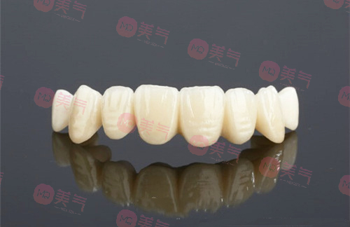 鎳鉻烤瓷牙和鈷鉻烤瓷牙哪個(gè)好，烤瓷牙修復(fù)優(yōu)缺點(diǎn)有哪些？