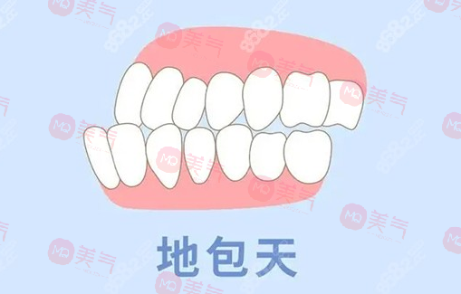 地包天矯正需要多少費用？骨性地包天整形費用2-4萬起