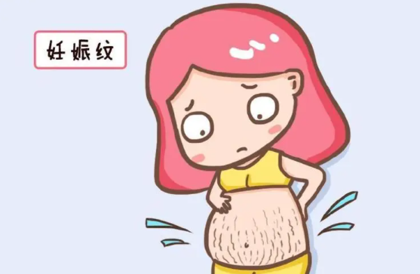 去妊娠紋